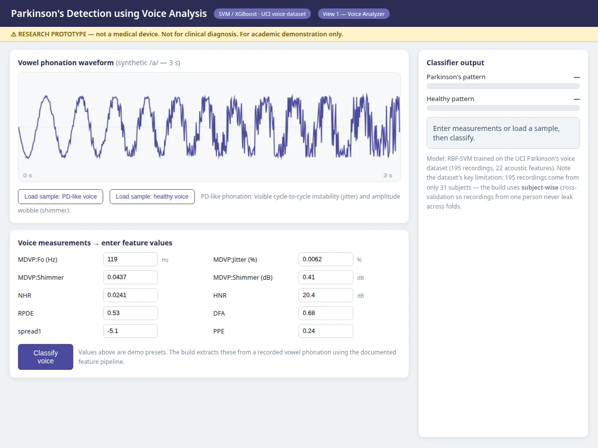 Parkinson's Detection using Voice Analysis — project thumbnail preview