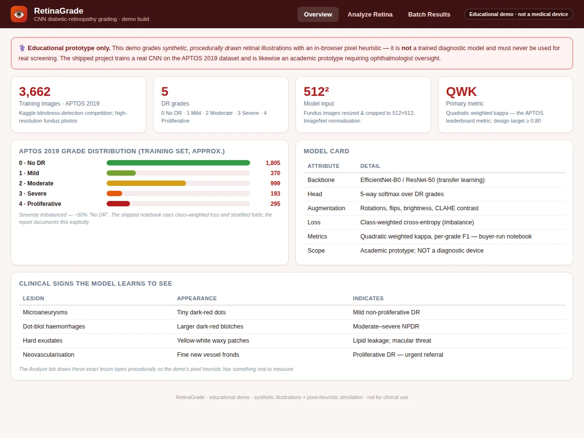 Diabetic Retinopathy Detection using CNN — project thumbnail preview
