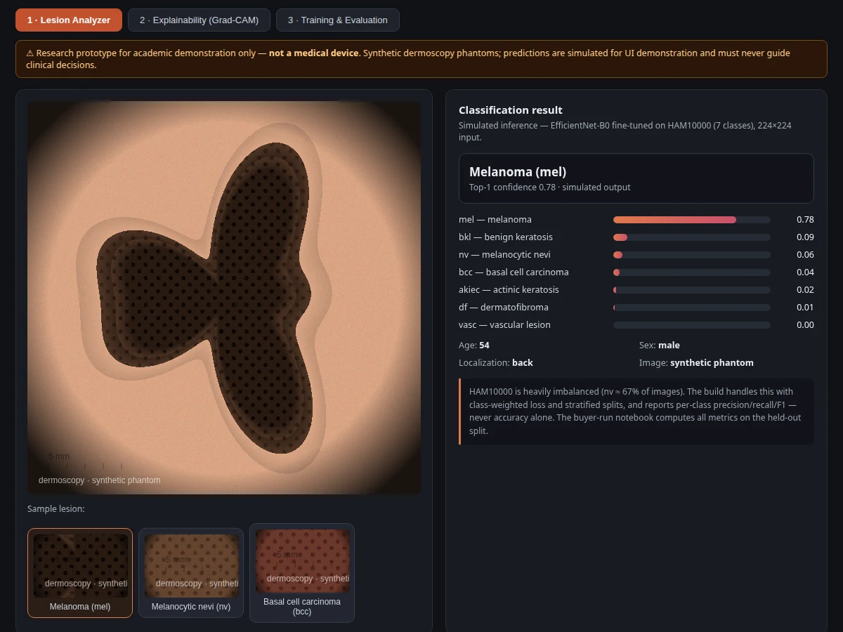 Skin Cancer Classification using CNN — project thumbnail preview