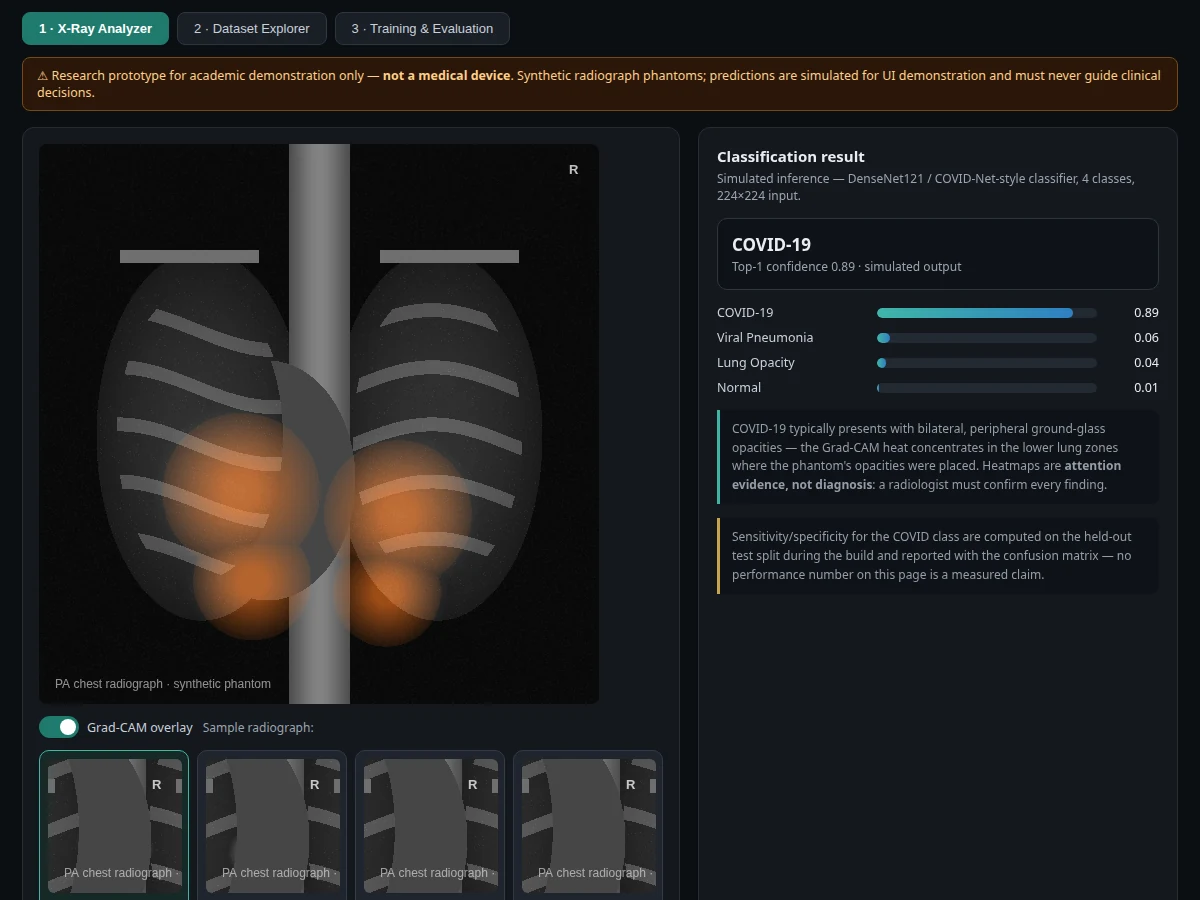 COVID-19 Detection using Chest X-Rays — project thumbnail preview