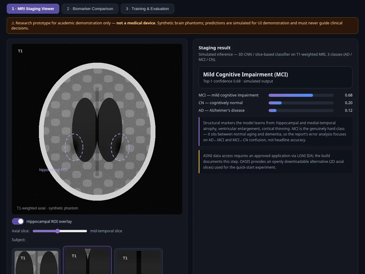 Alzheimer's Detection using MRI — project thumbnail preview