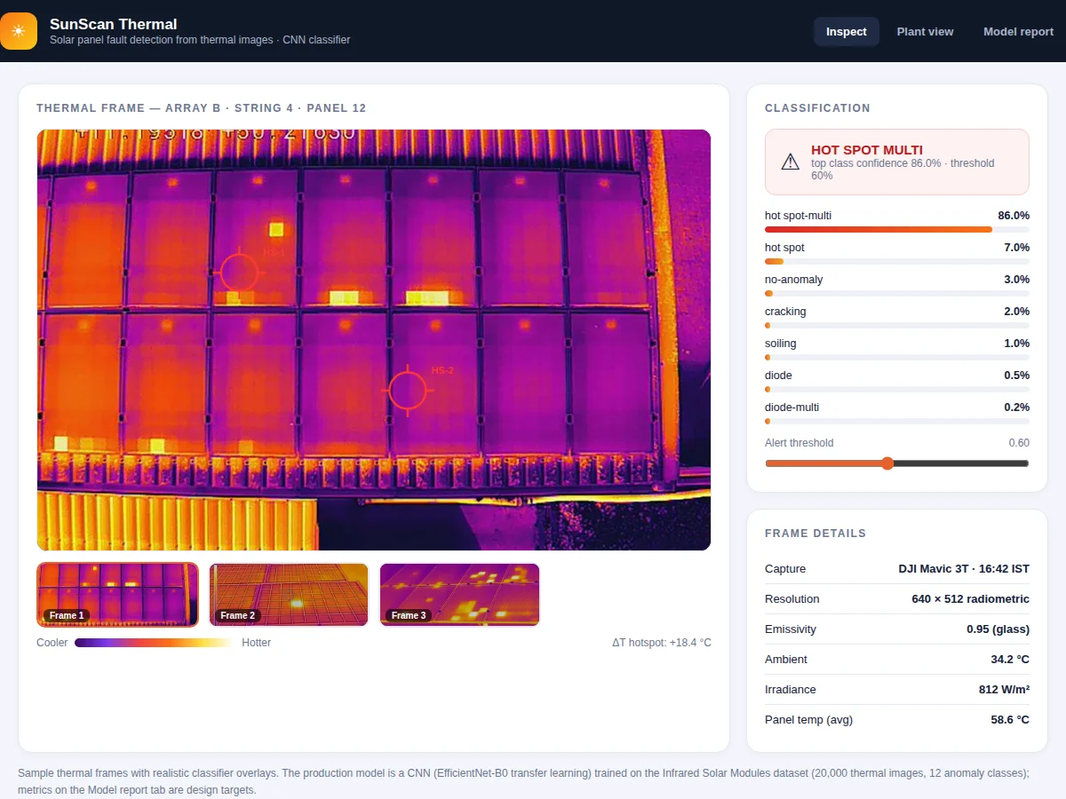 Malaria Parasite Detection in Blood Cell Images using CNN — project thumbnail preview